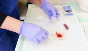 Detailaufnahme aus dem Labor: Eine Blutprobe wird für die Untersuchung vorbereitet.